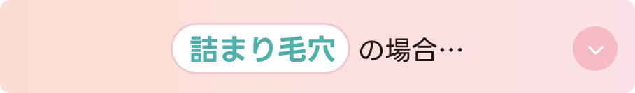 詰まり毛穴の場合…